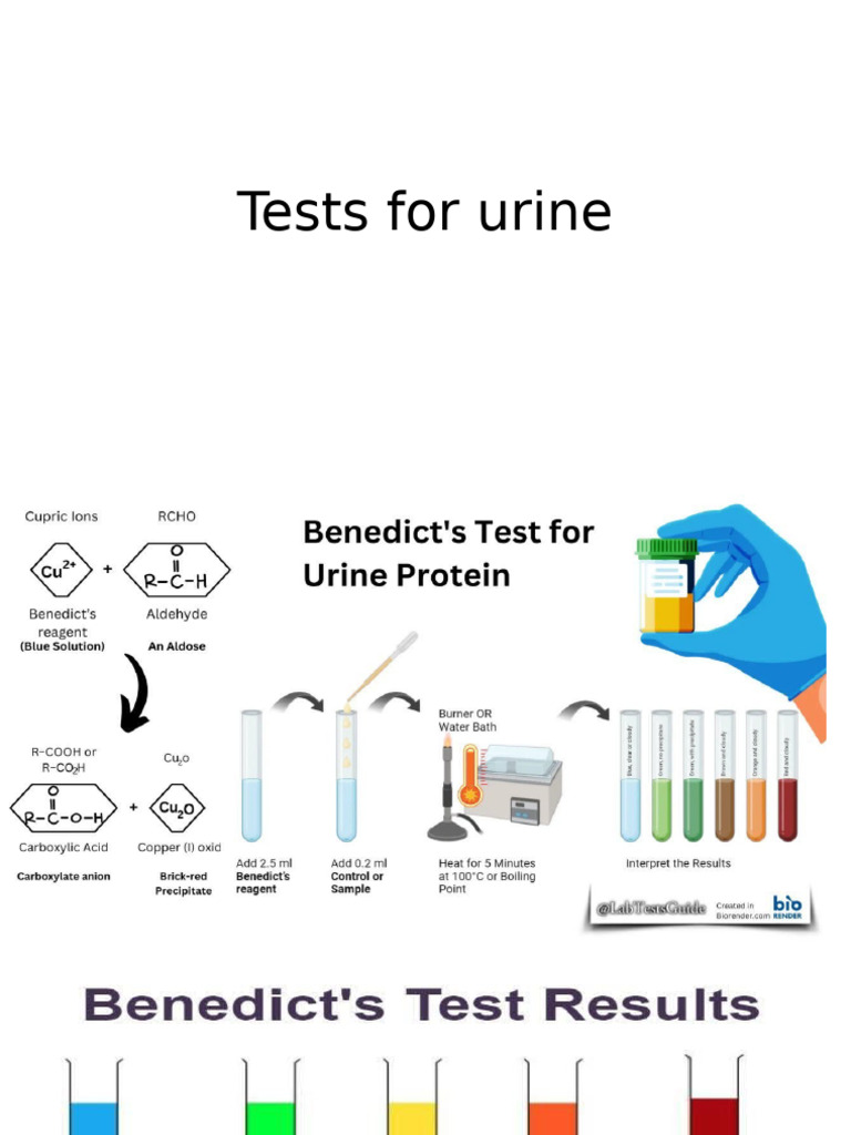 Urine Tests | PDF