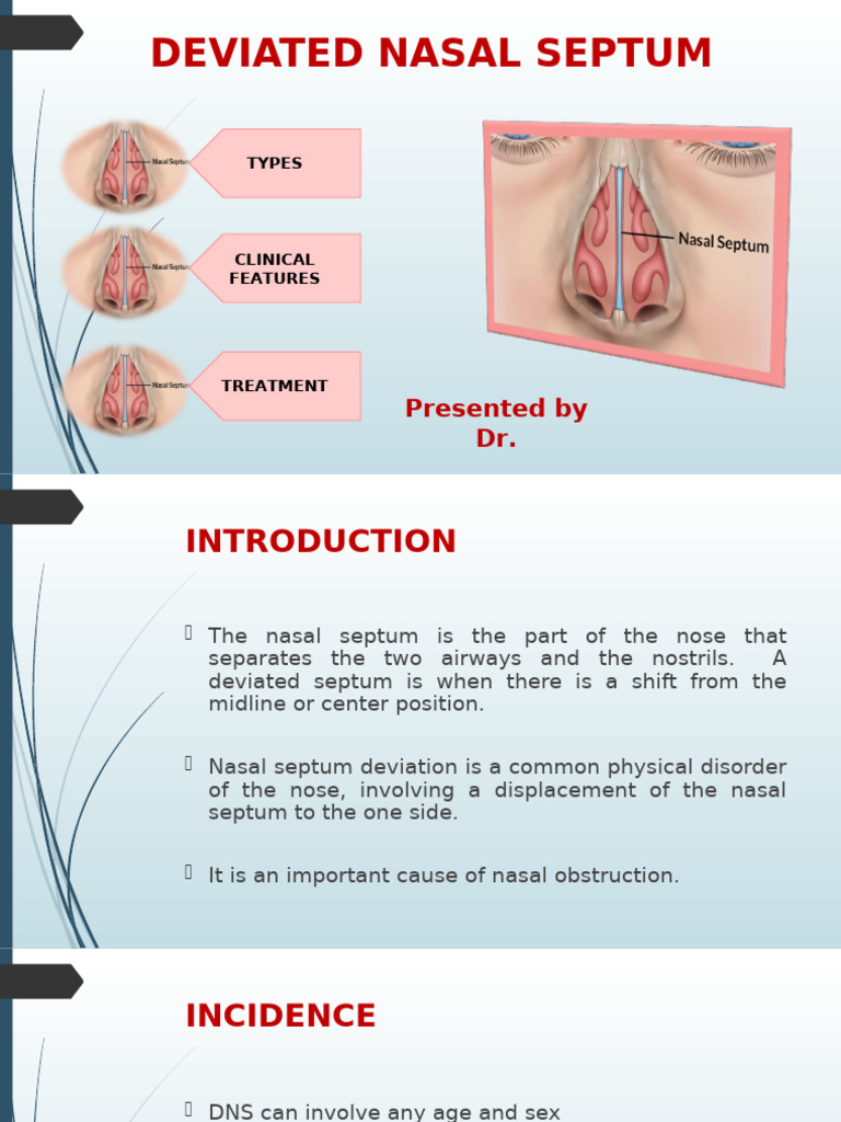 Types and Treatment of Deviated Septum | PDF | Human Nose | Respiratory ...