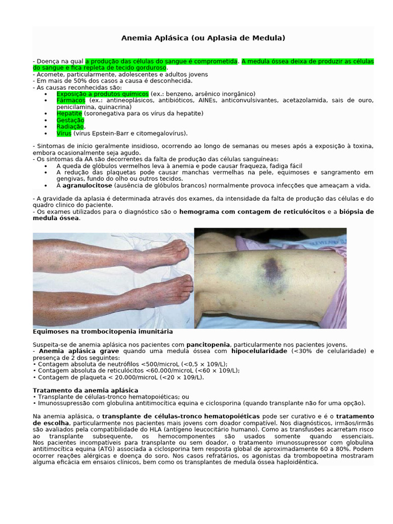 Causas e Tratamento da Anemia Aplásica | PDF | Anemia | Tecido (Biologia)