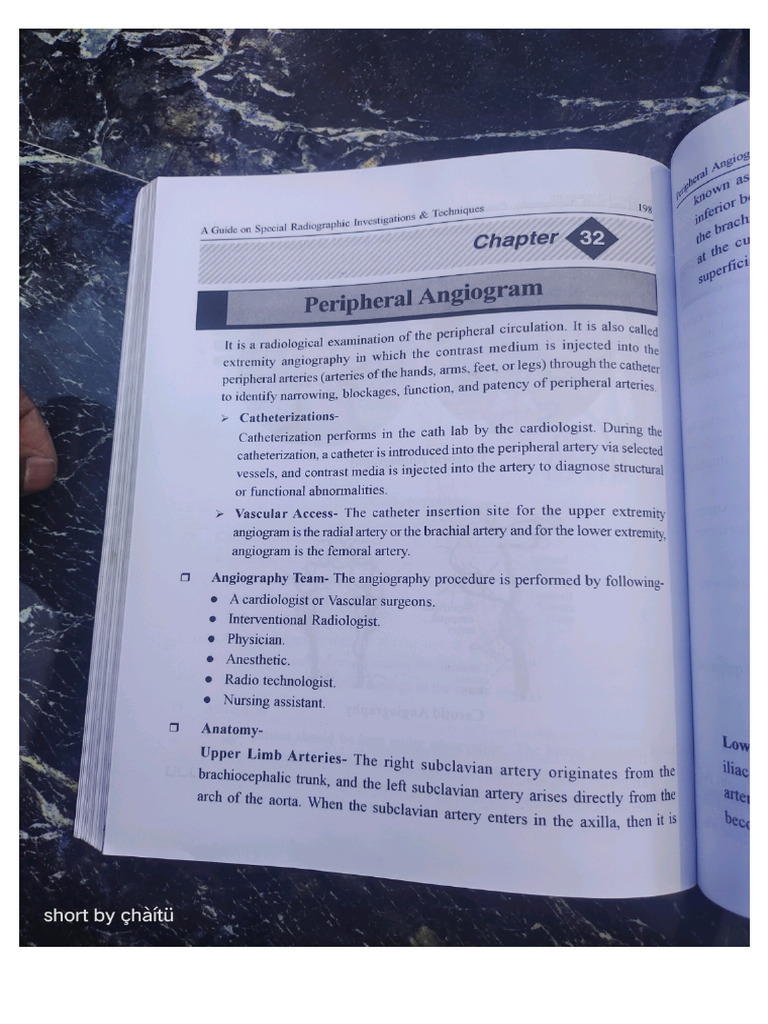 Peripheral Angiogram | PDF