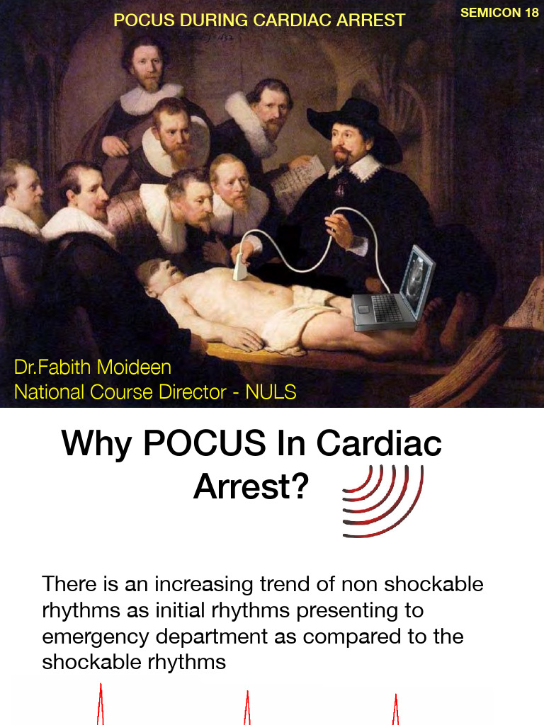 POCUS in Cardiac Arrest Management | PDF | Cardiac Arrest ...