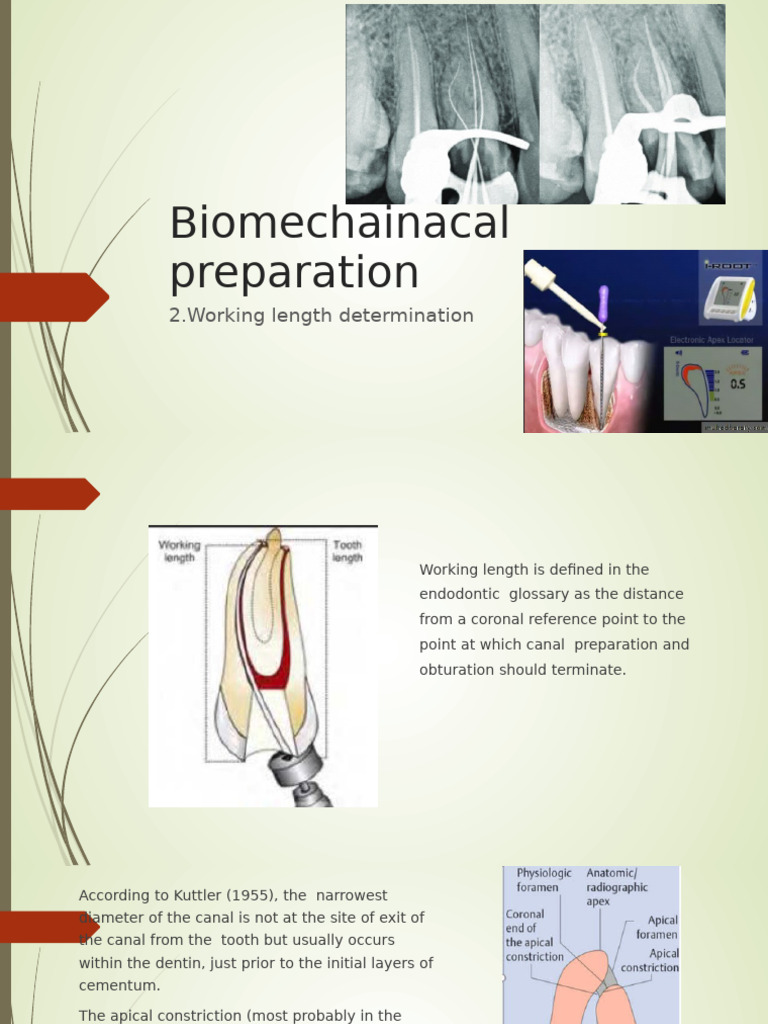 biomechanical preparation 2 mod. WL | PDF | Dentistry | Medical Specialties