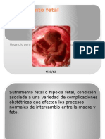 Sufrimiento Fetal