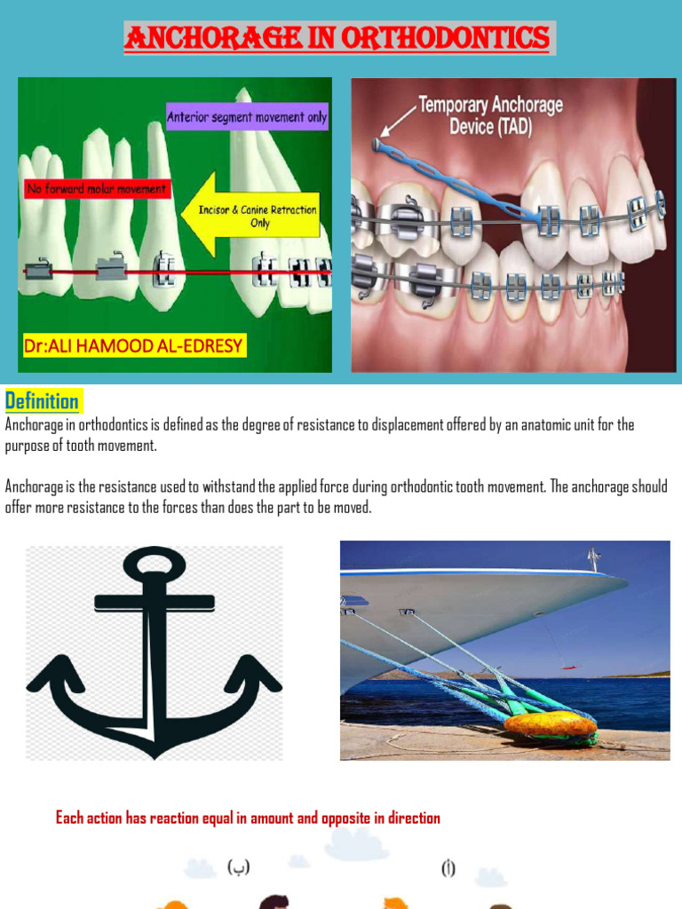 3-Anchorage in Orthodontics | PDF | Dental Implant | Dentistry Branches