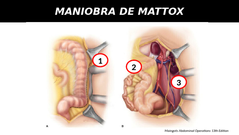 MATTOX | PDF