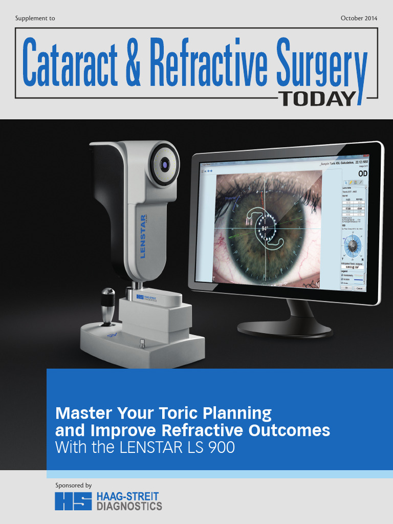 Optimize Toric IOL Planning with LENSTAR | PDF | Ophthalmology | Human Eye