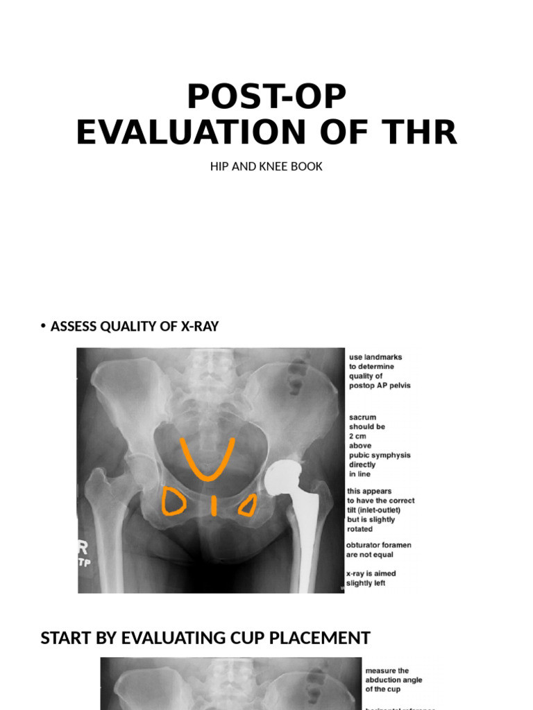 THR Post-Op Evaluation Guide | PDF