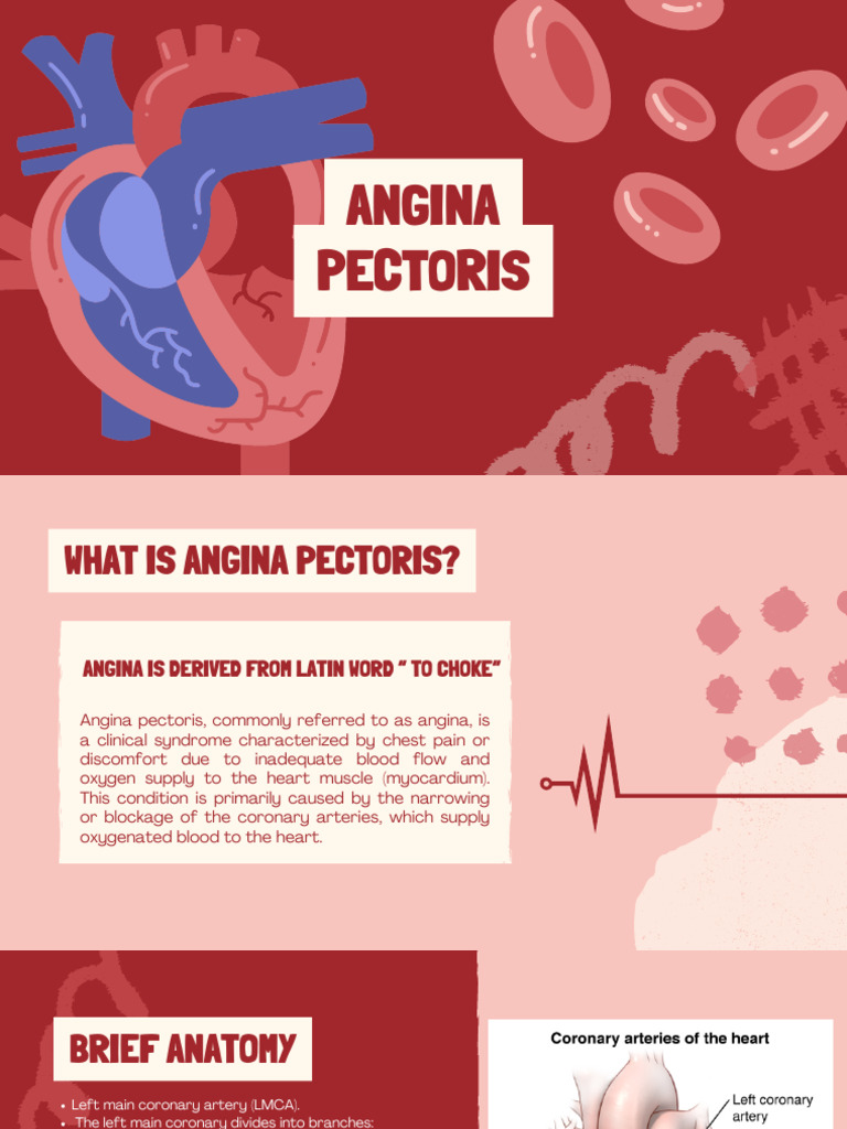 Understanding Angina Pectoris Symptoms | PDF | Coronary Circulation ...
