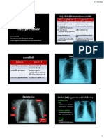 191 CXR - Interpretation 20111117165446