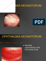 Opthalmia Um