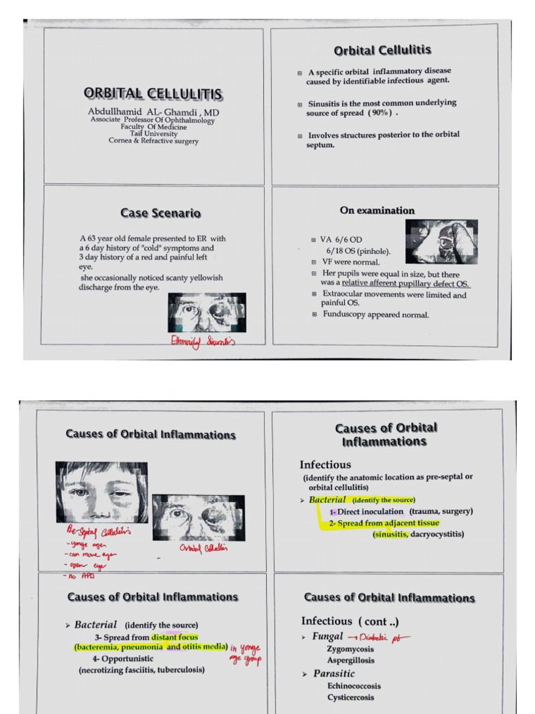 Orbital Cellulitis (My Notes) (5th Year) | PDF