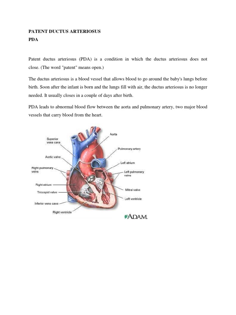 Understanding Patent Ductus Arteriosus | PDF | Aorta | Heart