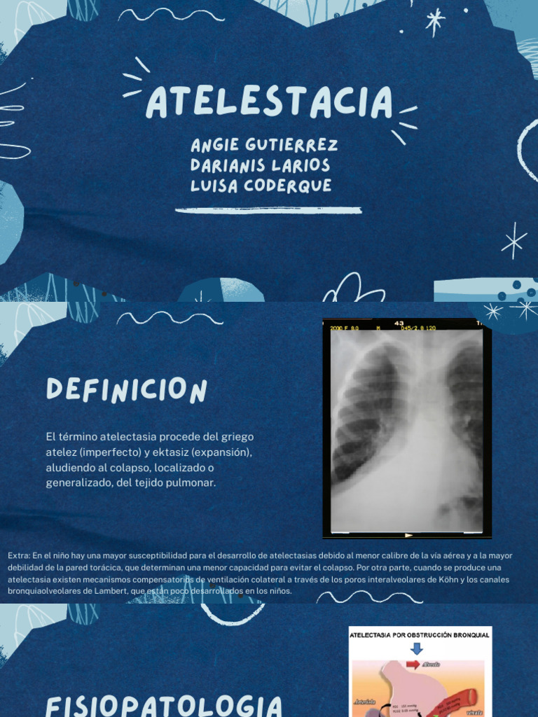 ATELESTASIA | PDF