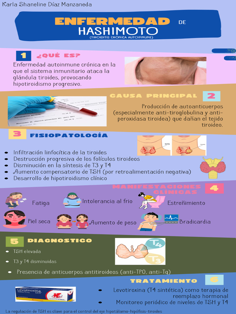 Infografía de La Enfermedad de Hashimoto | PDF