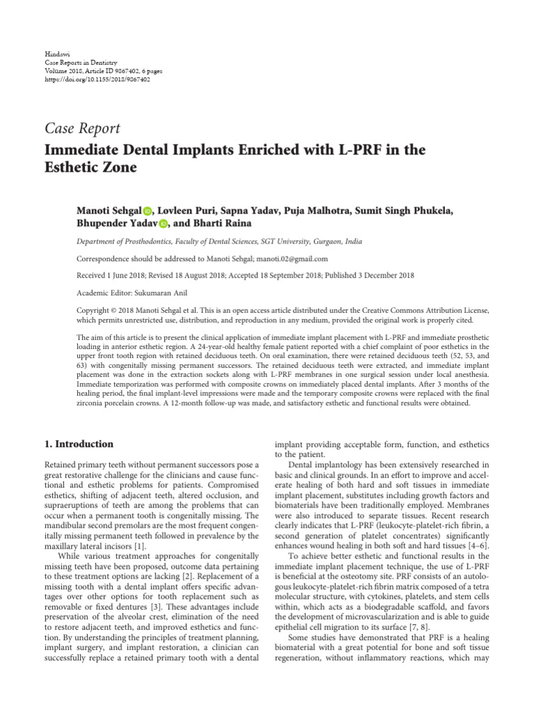 Immediate Implants with L-PRF in Aesthetics | PDF | Dental Implant ...