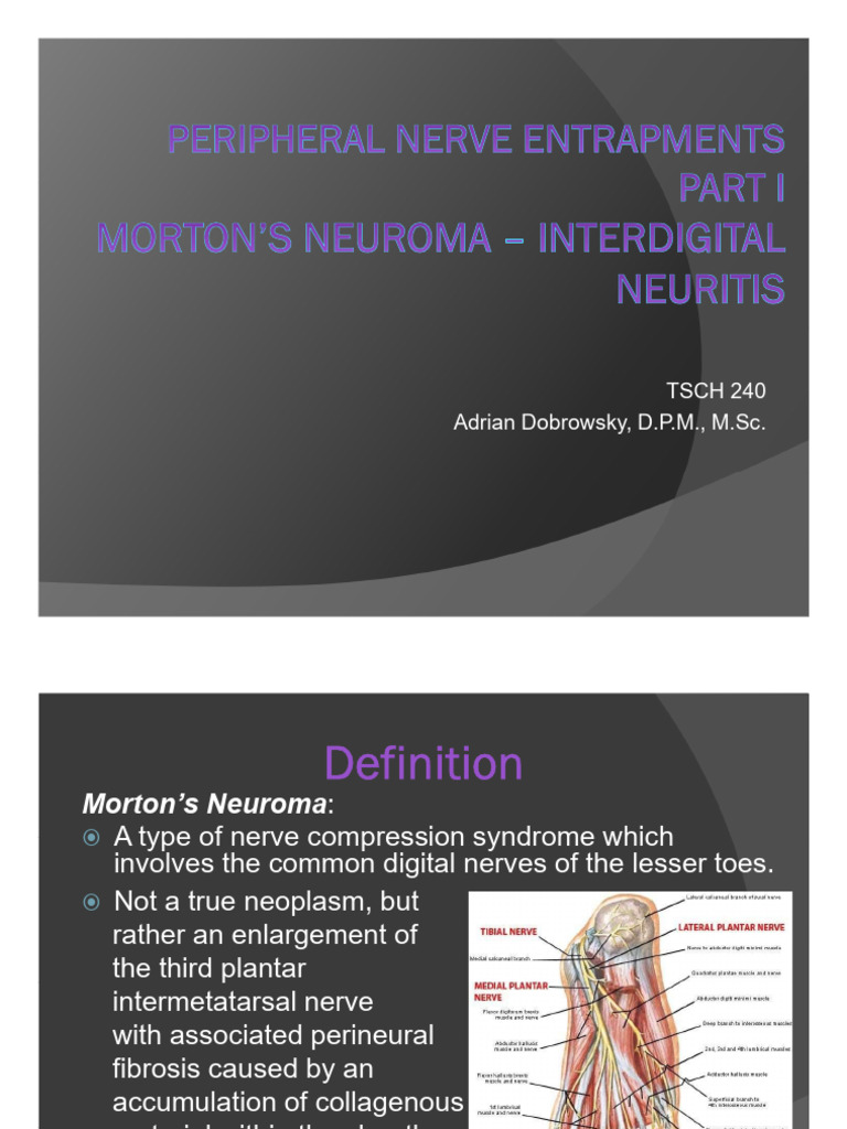 2nd Interspace Neuroma Overview | PDF | Foot | Toe