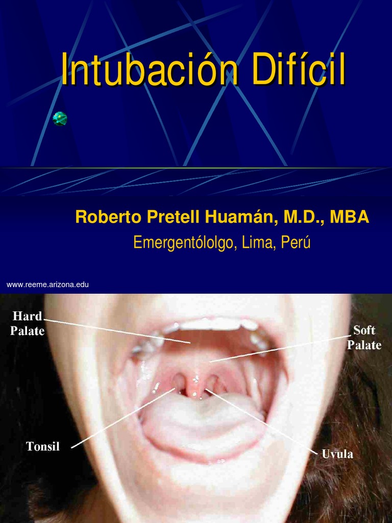 Intubación Difícil1 | PDF | Diente humano | Anatomía humana