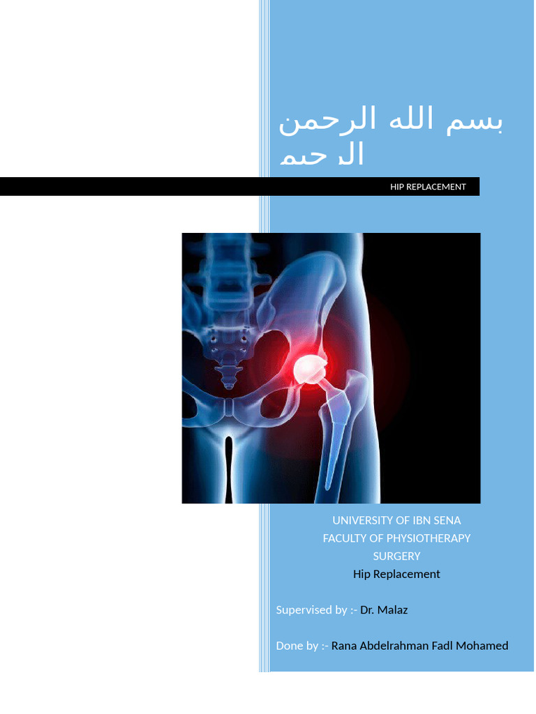 Comprehensive Guide to Hip Replacement | PDF | Hip | Surgery