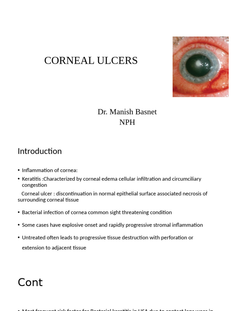 Corneal Ulcers: Causes and Treatment | PDF | Cornea | Human Eye