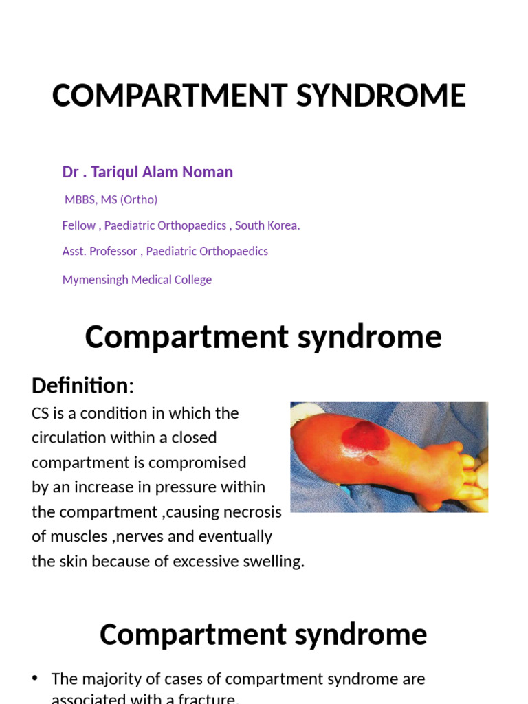 Hand Fasciotomy in Compartment Syndrome | PDF | Medical Specialties ...