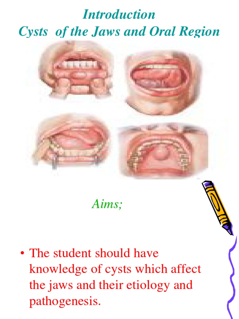 Introduction Cysts of Jaws Epithelium Mouth