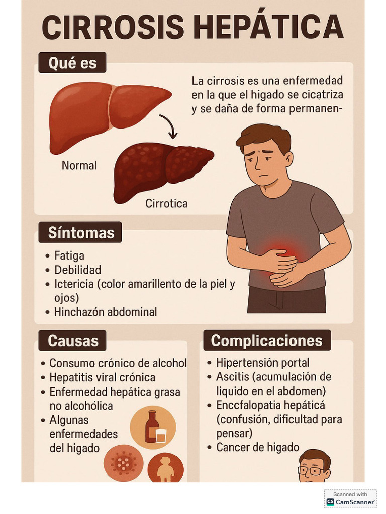 Cirrosis Biliar | Cirrosis | Epidemiología