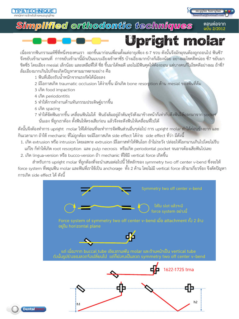 Upright Molar | PDF