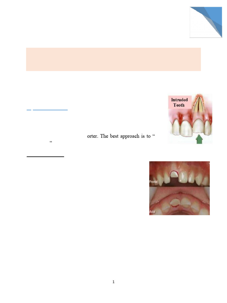 Displacement of Anterior Teeth in Pedodontics | PDF | Human Tooth ...