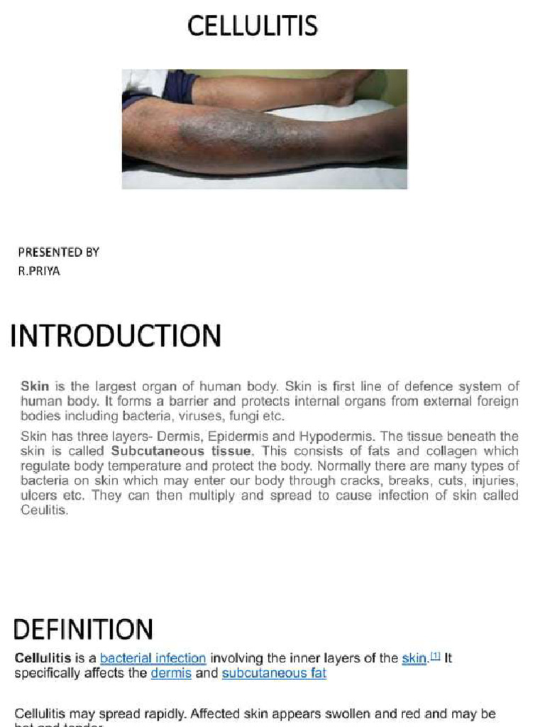 Cellulitis | PDF