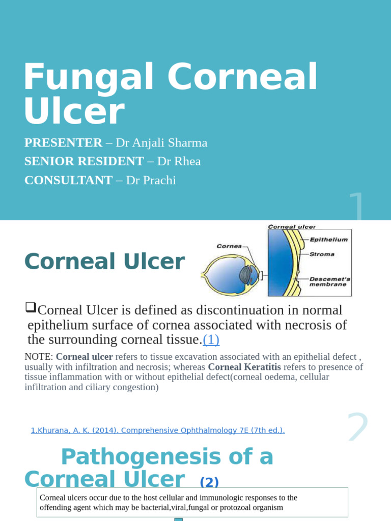 Fungal Corneal Ulcer: Diagnosis & Management | PDF | Cornea | Ophthalmology