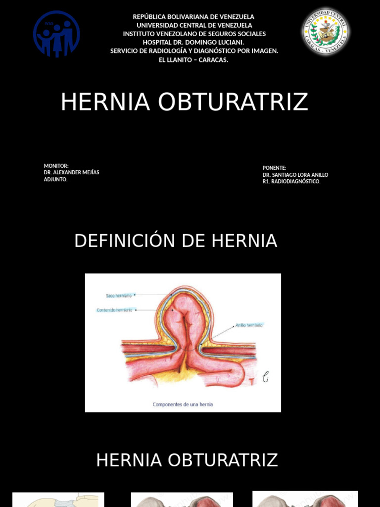 hernia-obturatriz-pdf