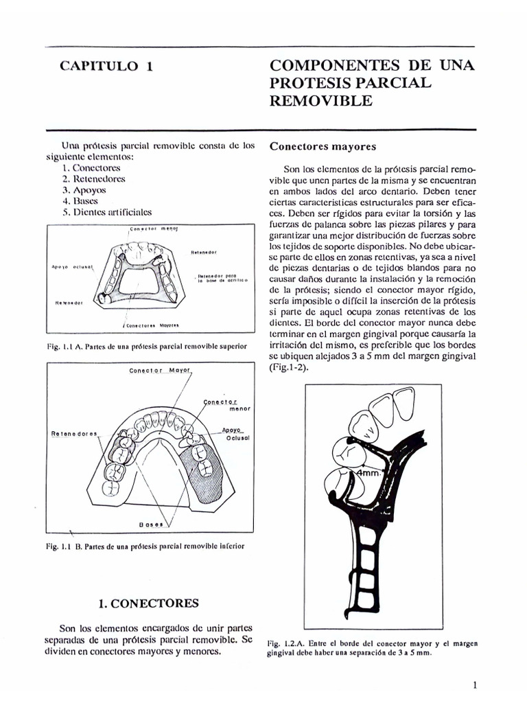 Capitulo 1 Componentes de Una Protesis Parcial Removible | PDF