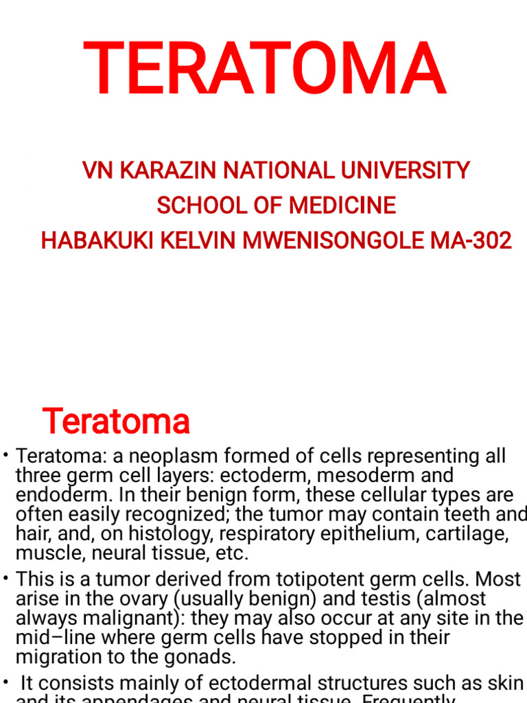 Understanding Teratomas: Types and Features | PDF