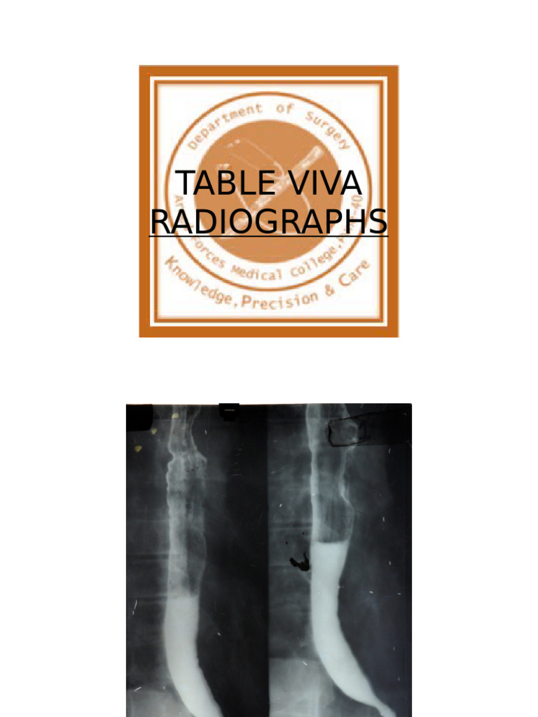 Achalasia Cardia Diagnosis and Management | PDF | Medical Specialties ...