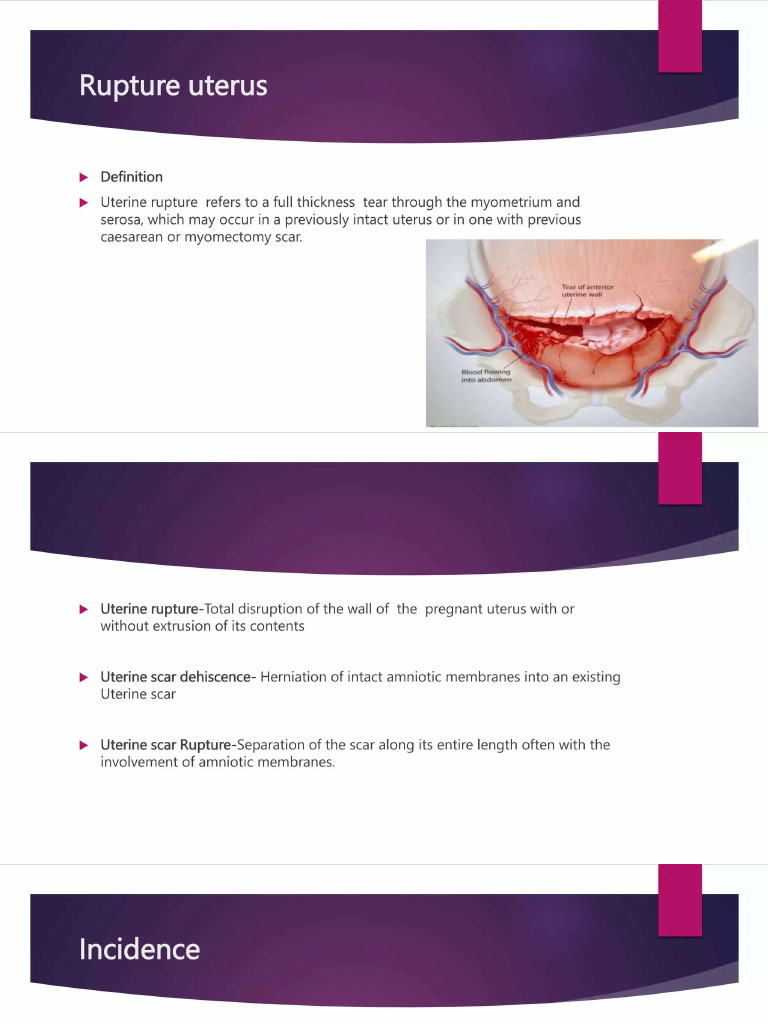 Rupture Uterus | PDF