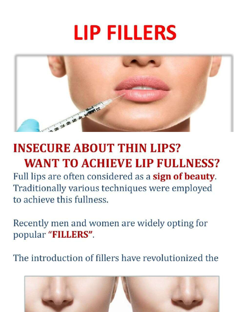 Lip Filler | PDF