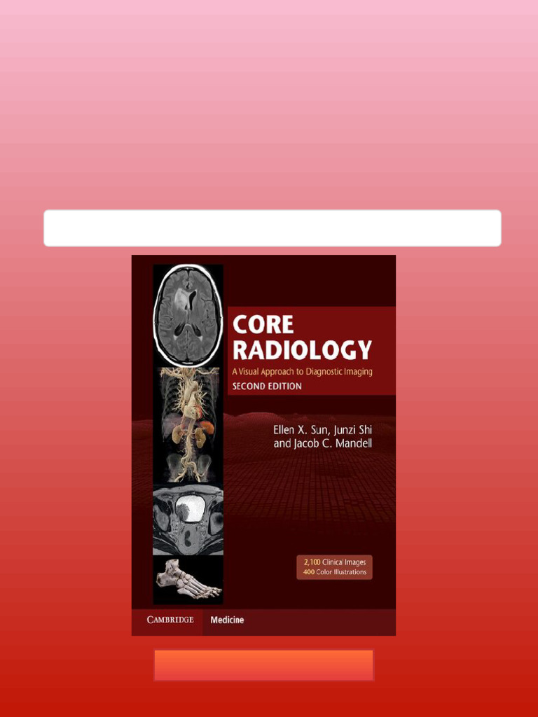 Diagnostic Radiology 7th Ed 1,2巻 3-s2.0-C20160004369-cov150h.gif