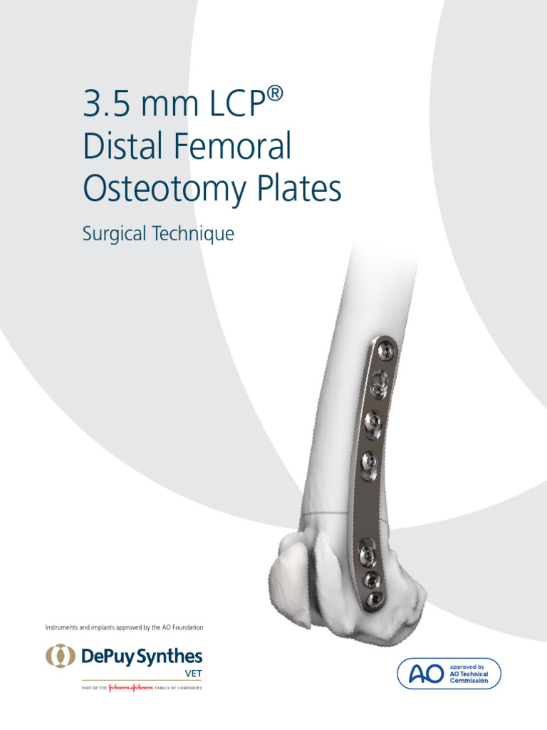 3.5 mm LCP Distal Femoral Osteotomy Guide | PDF | Screw | Drill