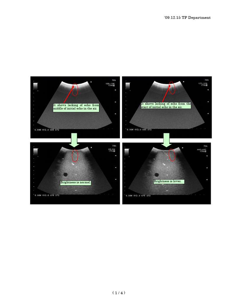 Unevenness of Initial Echo | PDF | Light | Applied And ...