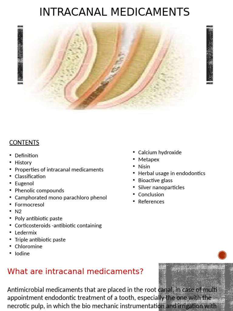 Overview of Intracanal Medicaments | PDF | Antimicrobial | Iodine