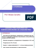 Neoplasias Uterinas