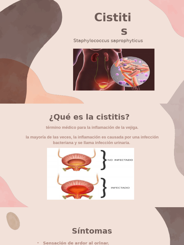Cistitis | PDF