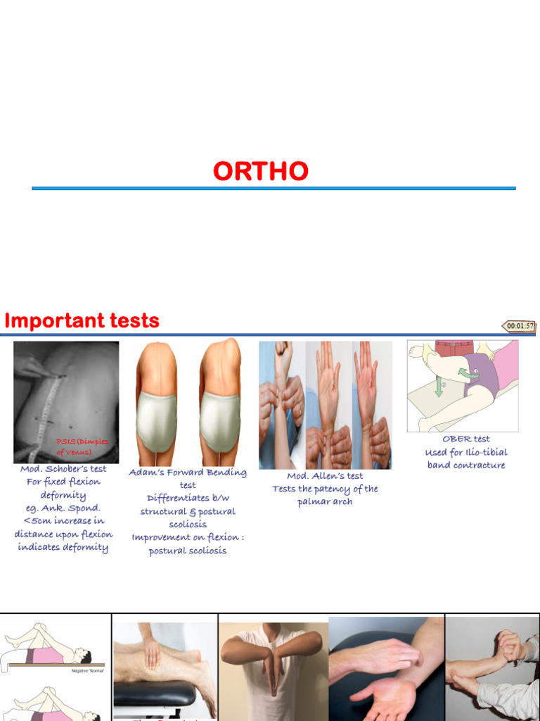 Ortho 2.0 - Dr. Risheek Gupta | PDF | Human Anatomy | Musculoskeletal ...