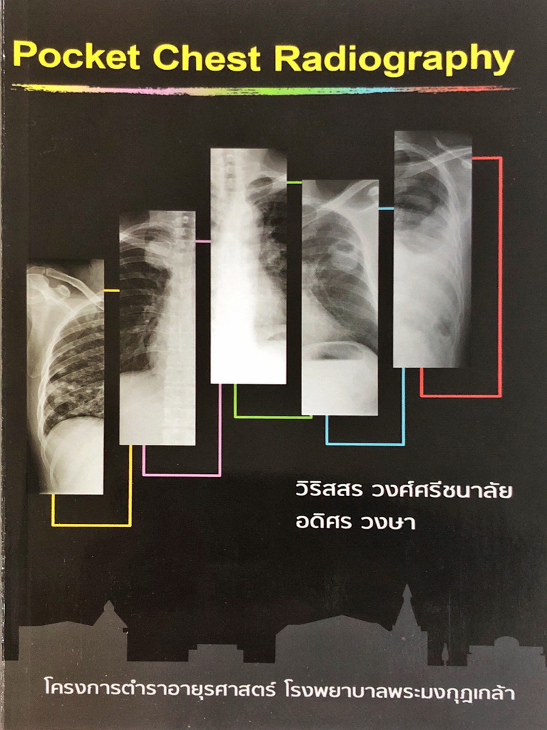 หนังสือ Pocket Chest Radiography วพม | PDF
