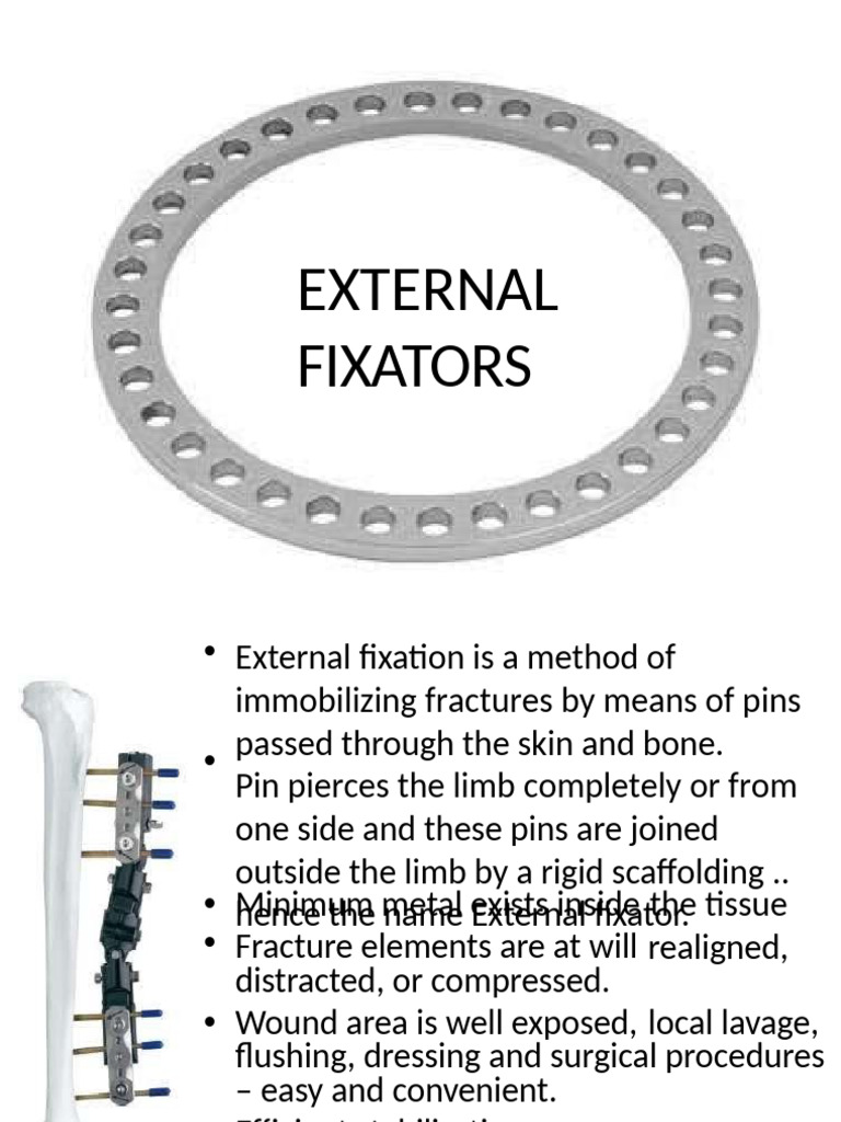 Overview of External Fixators in Orthopedics | PDF | Bone ...