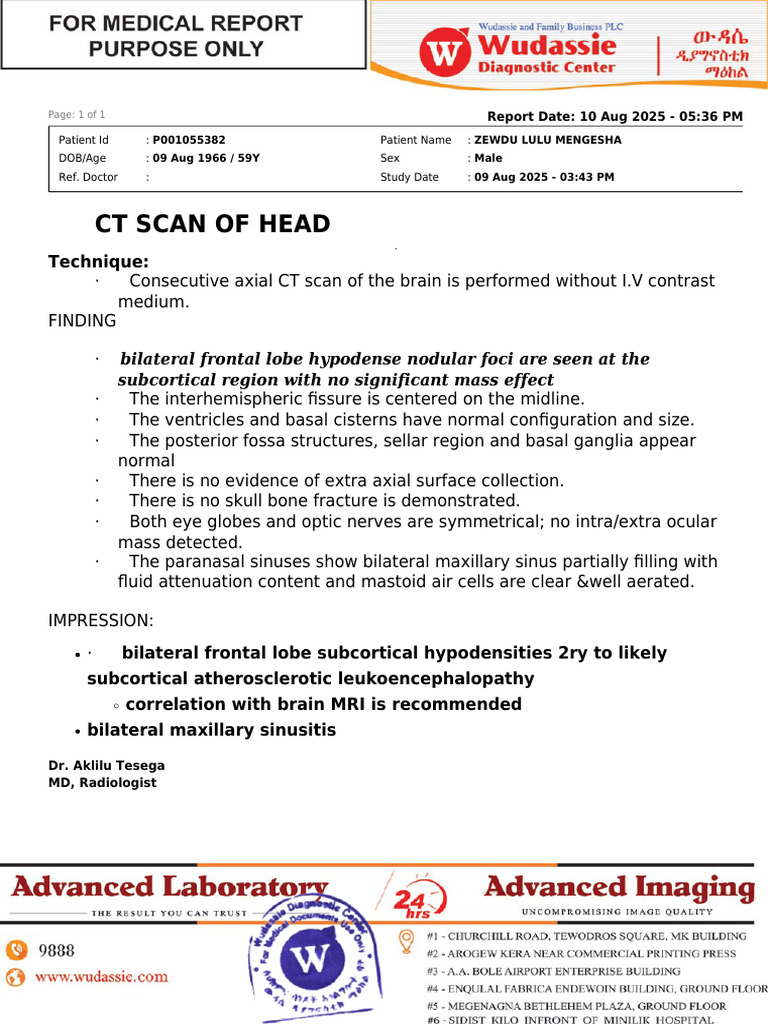 CT Head Scan Report: Frontal Lobe Findings | PDF