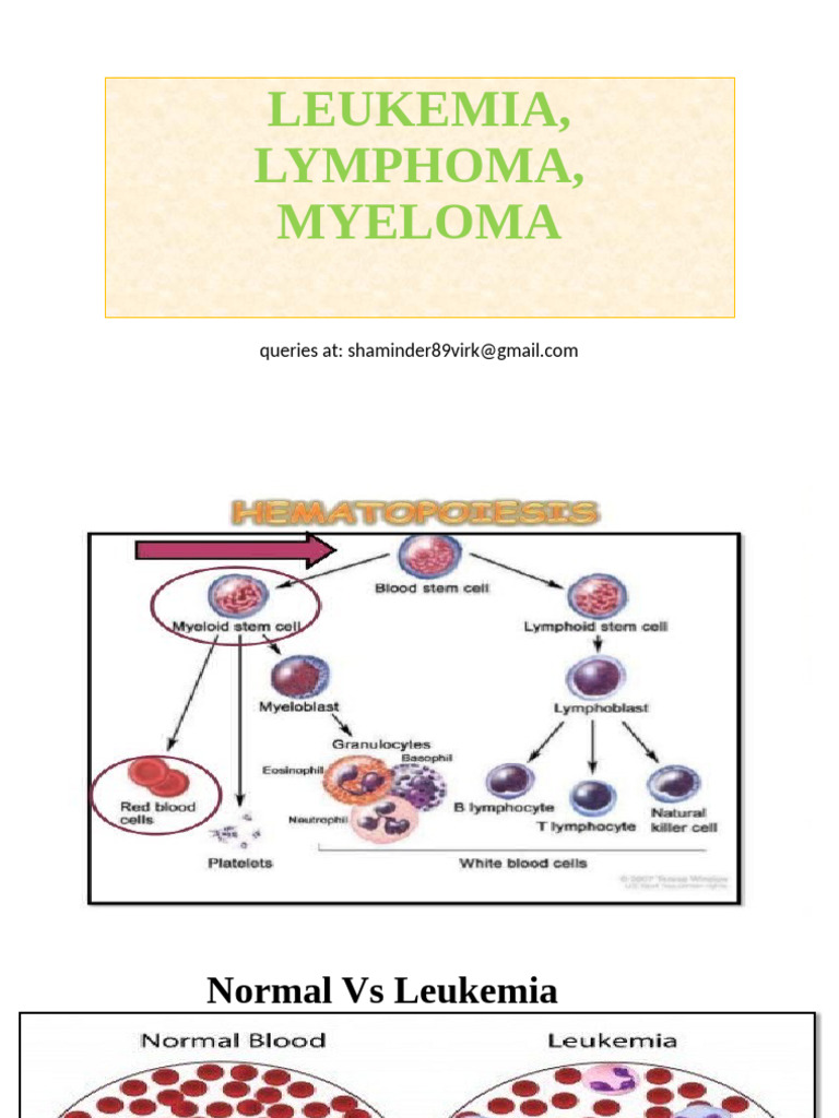 Overview of Leukemia Types and Treatments | PDF | Leukemia | Lymphoma