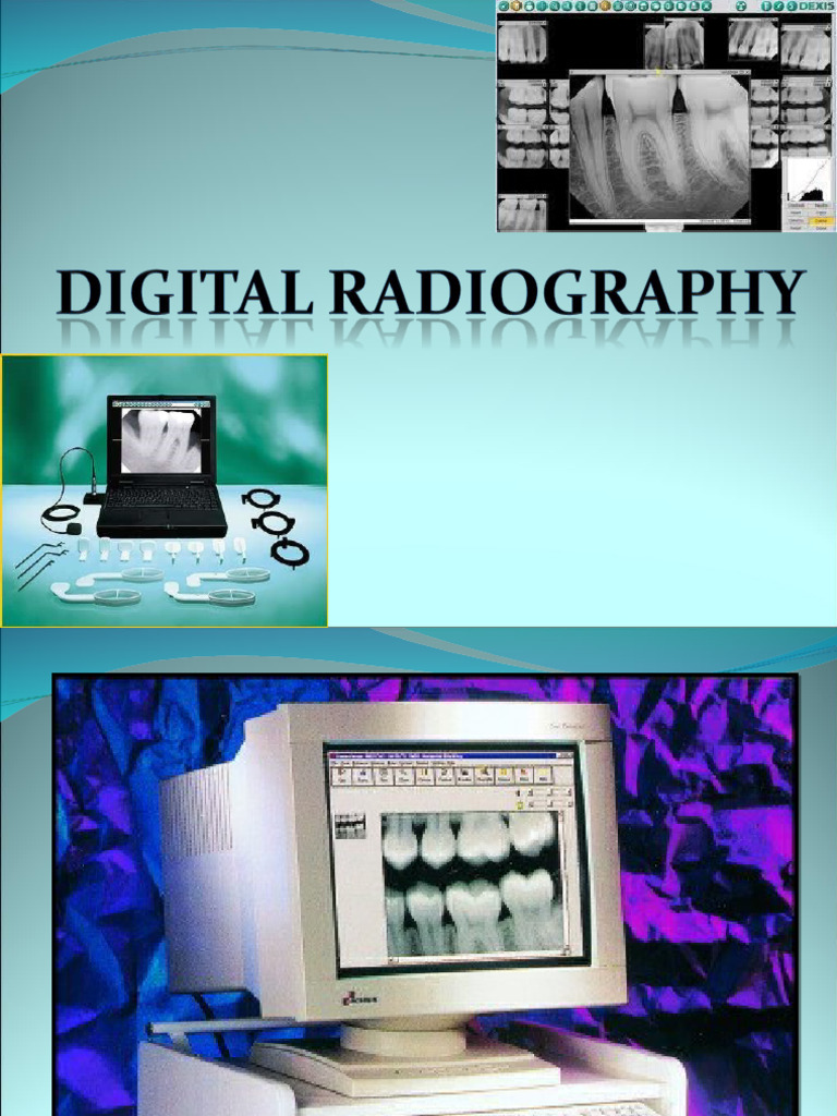 Digital Radiography: Overview & Benefits | PDF | Charge Coupled Device ...