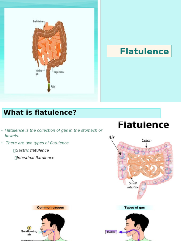 Understanding Flatulence and Peptic Ulcers | PDF | Flatulence | Stomach