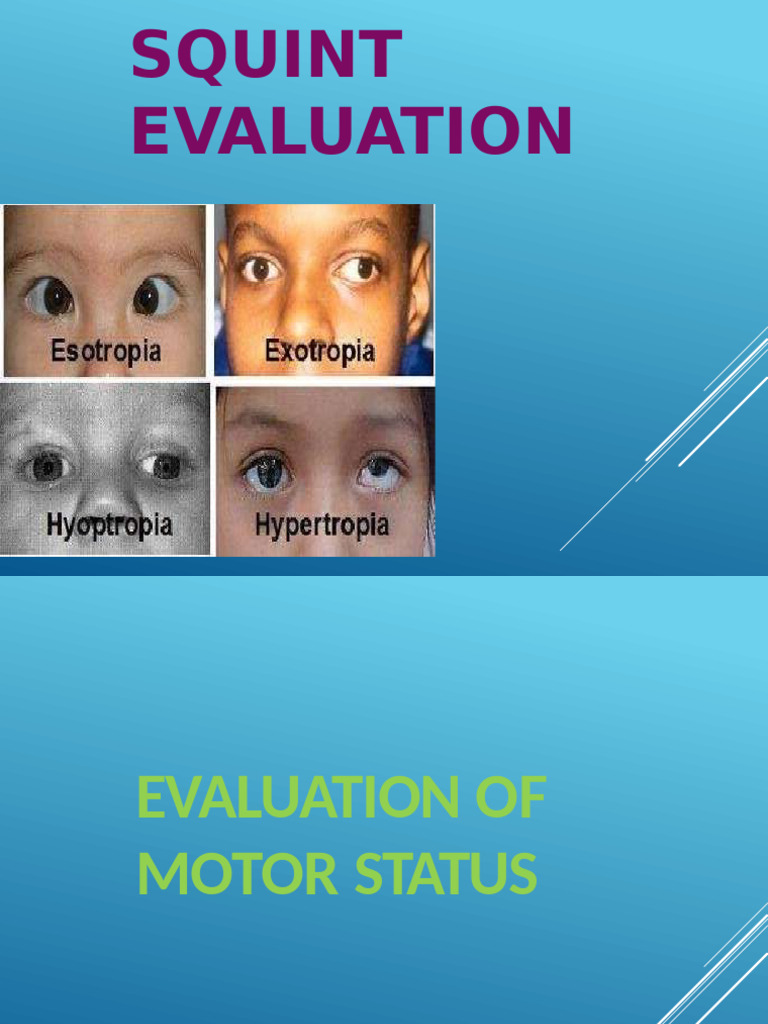 Squint Evaluation 2 Final 1 | PDF | Visual System | Eye